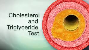 cholesterol testing and results