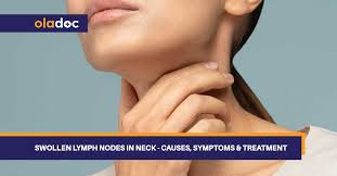 swollen lymph nodes in neck causes