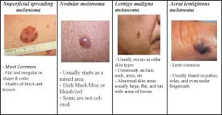 Removal Of Moles Nevus And Warts In Children Health Care