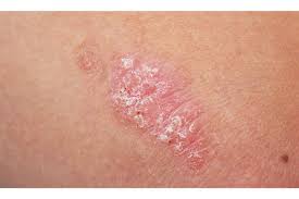 They are due to the development of abnormal cells that have the ability to invade or spread to other parts of the body. 5 Signs Of Skin Cancer Other Than An Abnormal Mole Towntalk Radio