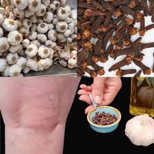 🥚My mother could NOT walk because of PAIN in her knees and bones until she tried! 🤩 Must express something to keep getting my recipes.... Thank you😍 Recipe in (c.o.m.m.e.n.t ).👇