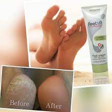Oriflame Beauty Product's - Oriflame feet-up advanced foot cream is an  intensive care complex that repairs and relieves cracked heels. Results are  visible in 3 days and cracked heels are fully improved
