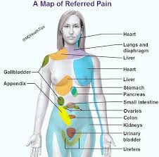 map of referred pain referred pain