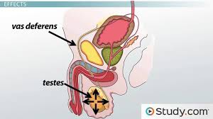 Because vasectomies are considered permanent sterilization, a lot of men men success rates depend primarily on the time since vasectomy. success rates can be as high as 95 percent if the. Vasectomy Purpose Advantages Disadvantages Video Lesson Transcript Study Com