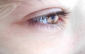 eyelid and orbital tumors pimples and
