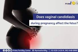 inal candidiasis during pregnancy
