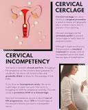Image result for icd 10 code for cerclage removal