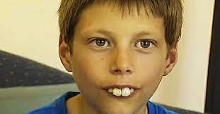 В 12 лет его называли мальчиком с самыми большими зубами. Как сложилась его  судьба | Пикабу