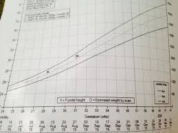 understanding 50th centile growth chart