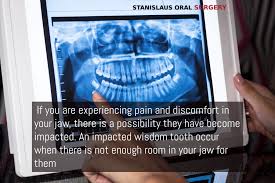 Some teeth can ache as bad as wisdom teeth. Surgical Removal Of Wisdom Teeth Oral Surgeon Modesto Ca
