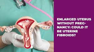 enlarged uterus without pregnancy