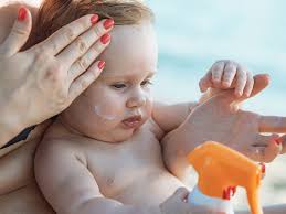 4 best ways to treat baby heat rash
