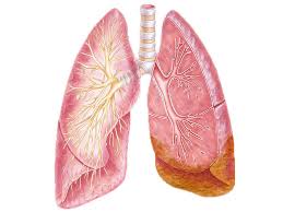 mesothelioma is a type of cancer that develops in the lining that covers the outer surface of some of the body&#x27;s organs. Mesothelioma Types Staging Diagnosis Treatment