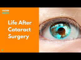 life after cataract surgery you