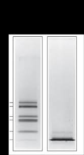 tricine sds page vs tris glycine sds