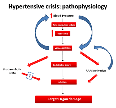 The Pathophysiology Of Hypertensive Crisis Download