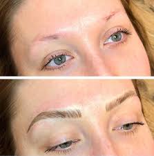 thinning eyebrows common causes best