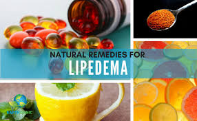 natural remes for lipedema
