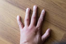 The most common cause of finger pain is a hand injury. 10 Reasons You Have Swollen Fingers Geelong Medical Health Group