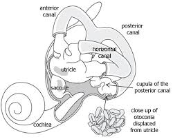 A maneuver which can be used to successfully treat a type of dizziness. Benign Paroxysmal Positional Vertigo Bppv Veda