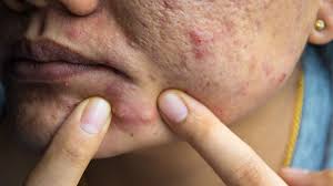 hard lump under the skin causes and