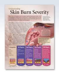 Understanding Skin Burn Severity Chart 20x26 Clinicalposters