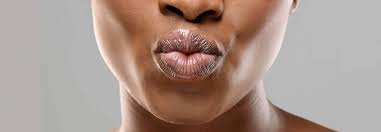 dry lip causes dry skin on lips