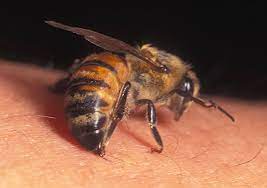 bee venom and the chemistry of ouch