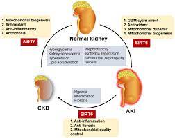 roles of sirt6 in kidney disease a