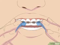 I couldnt find one, so ive decided to make my own. 3 Ways To Make Fake Braces Or A Fake Retainer Wikihow