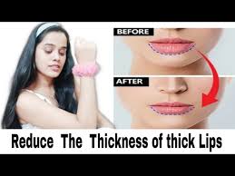 fat lip to thinner lips naturally