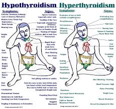 12 Ways To Treat Hyperthyroidism Naturally Thyroid Health