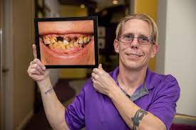 full mouth dental implants dentist