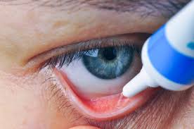 antibiotic eye ointments uses side