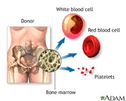 bone marrow transplant series normal