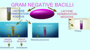 Flowchart Of Bacterial Tests Gram Negative Bacilli