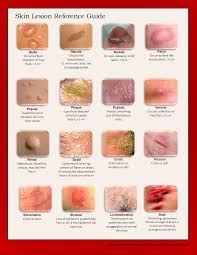 Image Result For Skin Lesion Guide Medical Nursing Exam