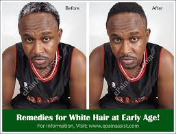 white hair at early age remes