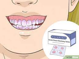 There is even a study from 2008 published in the journal of clinical dentistry that talks about this baking soda paste. 3 Ways To Remove Plaque Wikihow