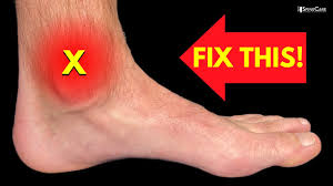 how to get rid of ankle pain at home