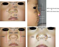 essment of the lip and nasal forms