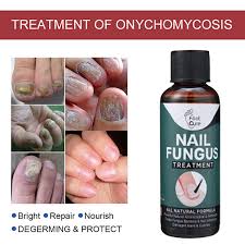 nail fungus treatment anti
