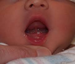 mouth newborn nursery stanford cine