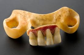 First one made by j. When Dentures Used Real Human Teeth Atlas Obscura