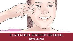 home remes for swelling