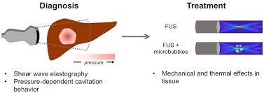 Solid Tumors For Improved Delivery