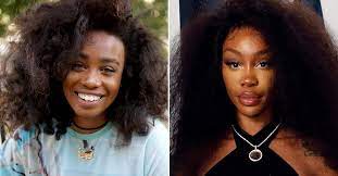 sza before surgery see the singer s