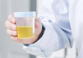 why do you see white particles in urine
