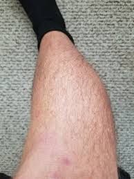 Scientists do not yet know. How To Get Rid Of Hairy Legs Quora