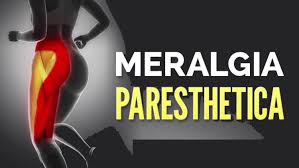 meralgia paresthetica causes